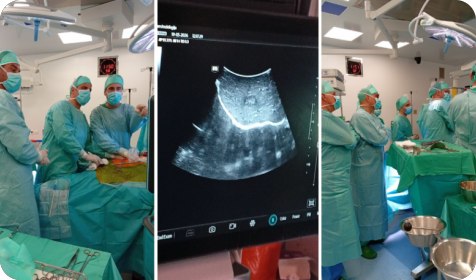 Opća bolnica Pula po prvi puta izvela intraoperativnu termalnu ablaciju metastaze u jetri-160775