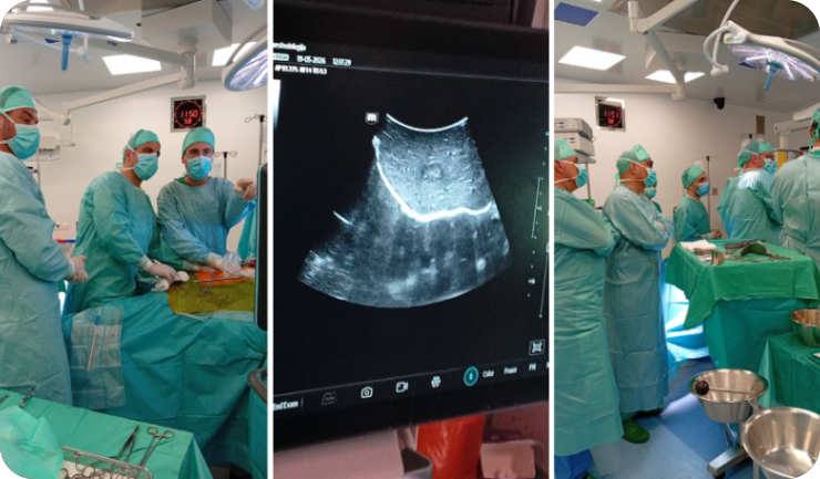 Opća bolnica Pula po prvi puta izvela intraoperativnu termalnu ablaciju metastaze u jetri-160775